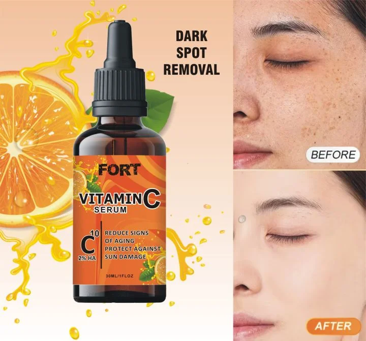 Vitamin C Brightening Serum